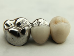 dental care