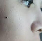 fair skin