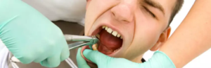 pain, tooth extraction, wisdom teeth