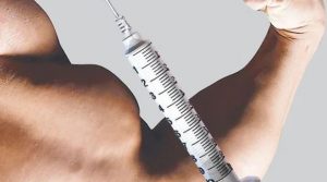 steroid injection